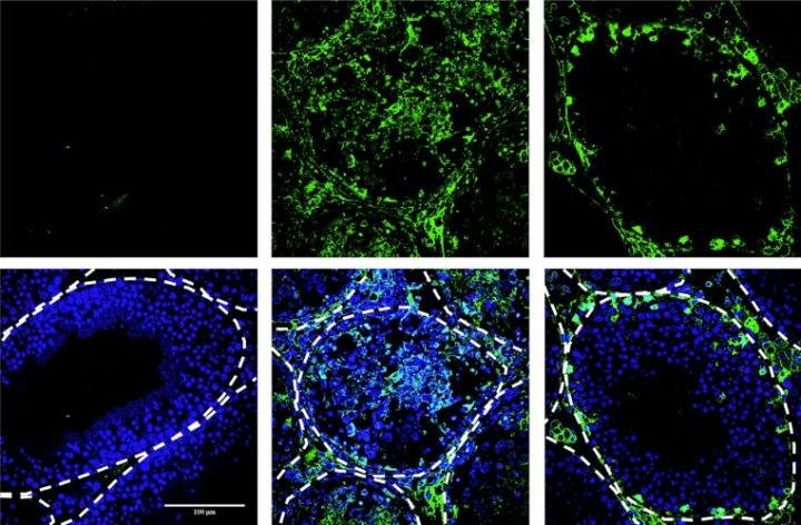 Antioxidant treatment prevents sexual transmission of Zika in mice