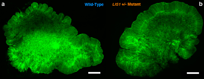 (a) Images of wild-type (WT) and (b) LIS1 mutant organoids (LIS1+-).