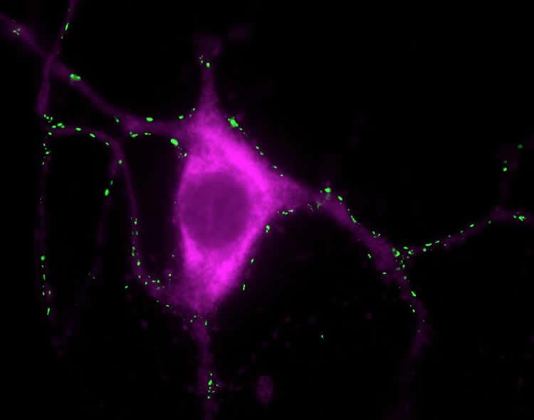 Tyrosine hydroxylase positive neuron stained with a synaptic marker. NeuroscienceNews.com image is credited to Janin Lautenschläger.