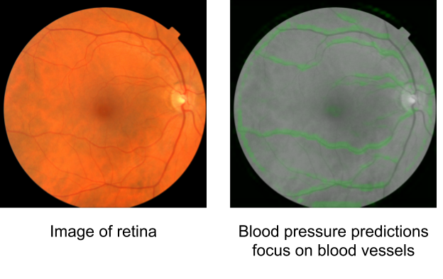 Google’s new AI algorithm predicts heart disease by looking at your eyes