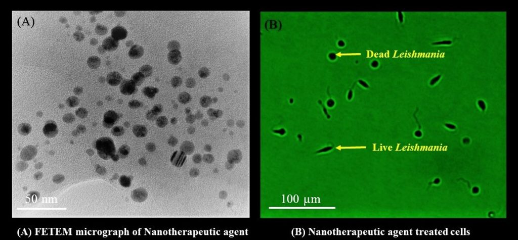 Leishmania donovani killed by nanosilver particles as seen under the microscope