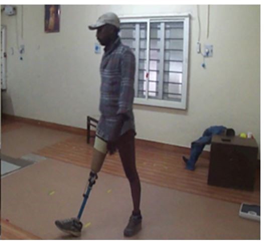 Patient walking with prosthetic knee joint