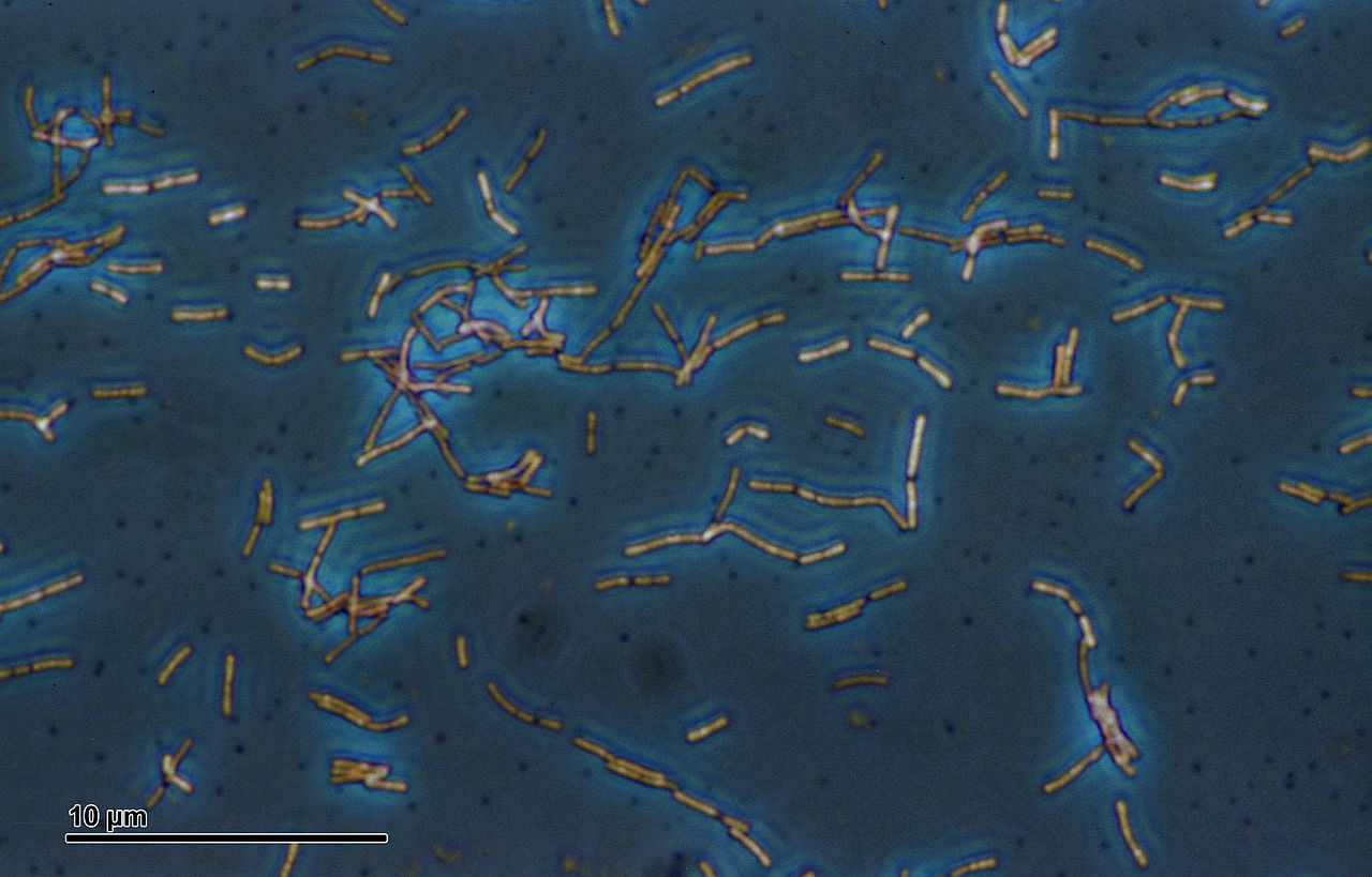 Scientists Explain Strange Behavior of Gut Bacteria Resistant to TB Drugs