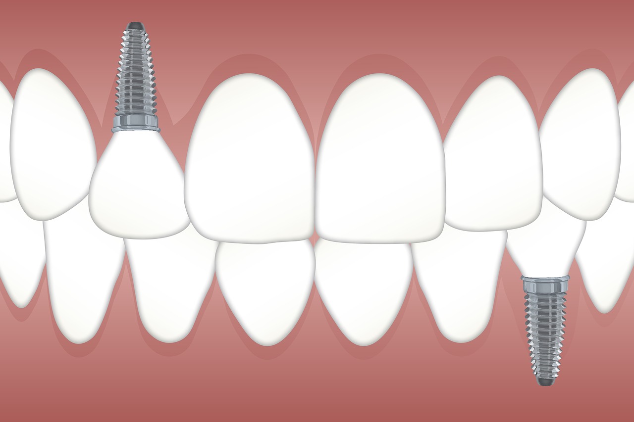 New Graphene-Based Material Developed for Medical Implants