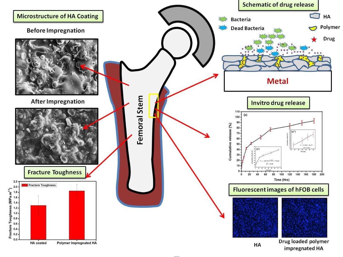 Drug-Coated Bone Implants May Help Tackle Post-Surgery Infections