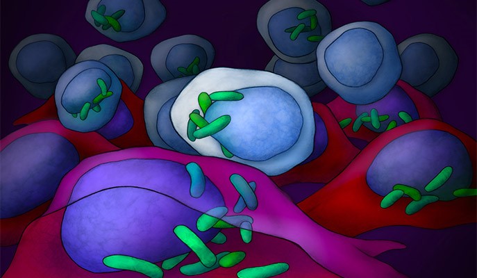 Cells inside Cells: The Bacteria That Live in Cancer Cells