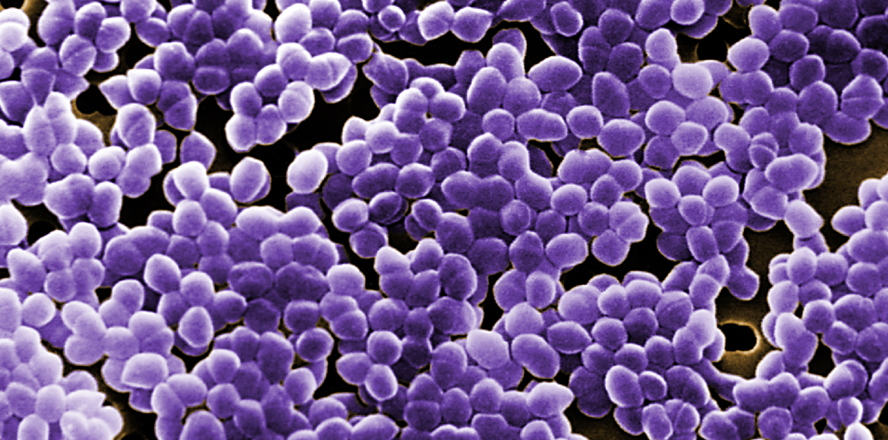 NIOT Develops Rapid PCR Kit to Detect Multi Drug Resistant Bacteria