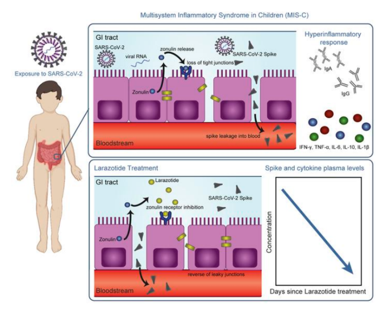 Researchers uncover mechanisms related to Multisystem Inflammatory Syndrome in children